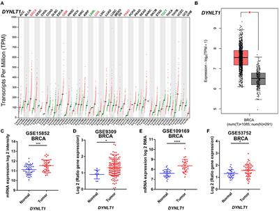 Identification of DYNLT1 associated with proliferation, relapse, and metastasis in breast cancer